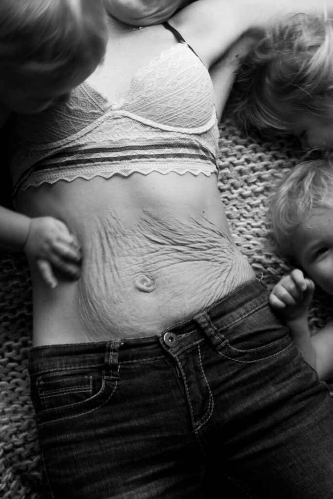postpartum depression